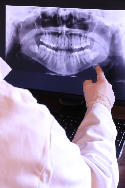 Best Emergency Tooth Extraction in Barnwell, SC